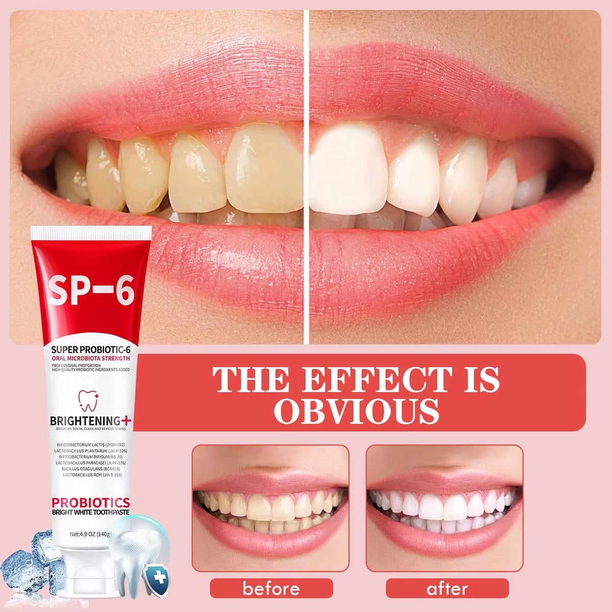 SP-6 Probiotic Toothpaste for Whitening & Deep Cleaning (120g)
